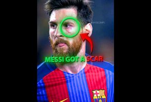 Messi's Scar Changed Everything ❤️‍ð©¹